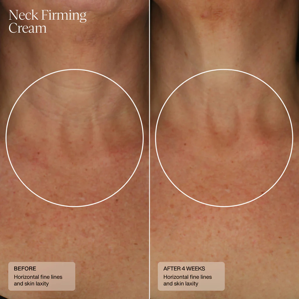 SENTE Neck Firming Cream